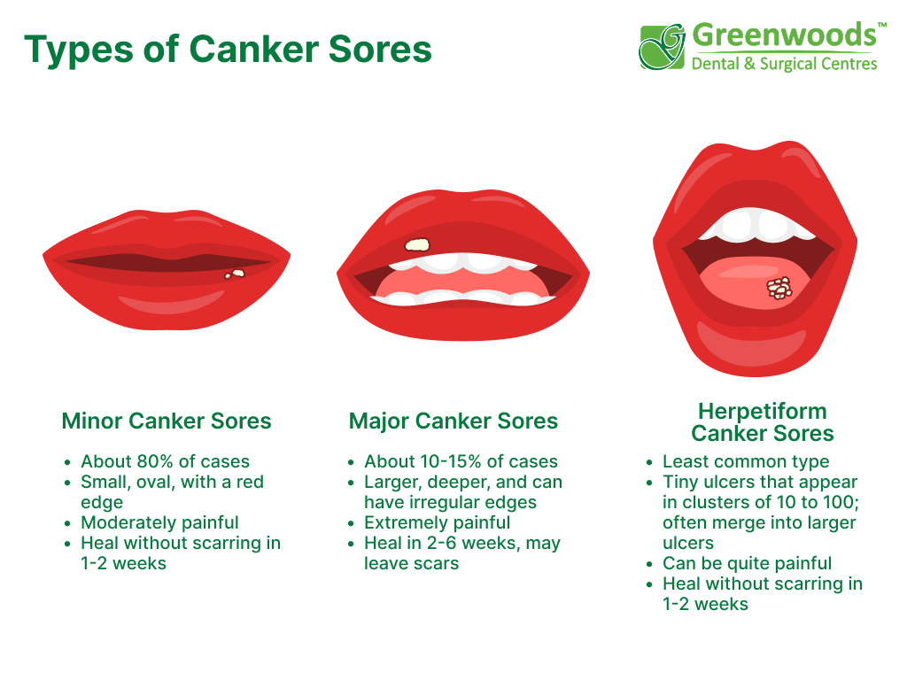 Types of Canker cores: minor, major, herpetiform