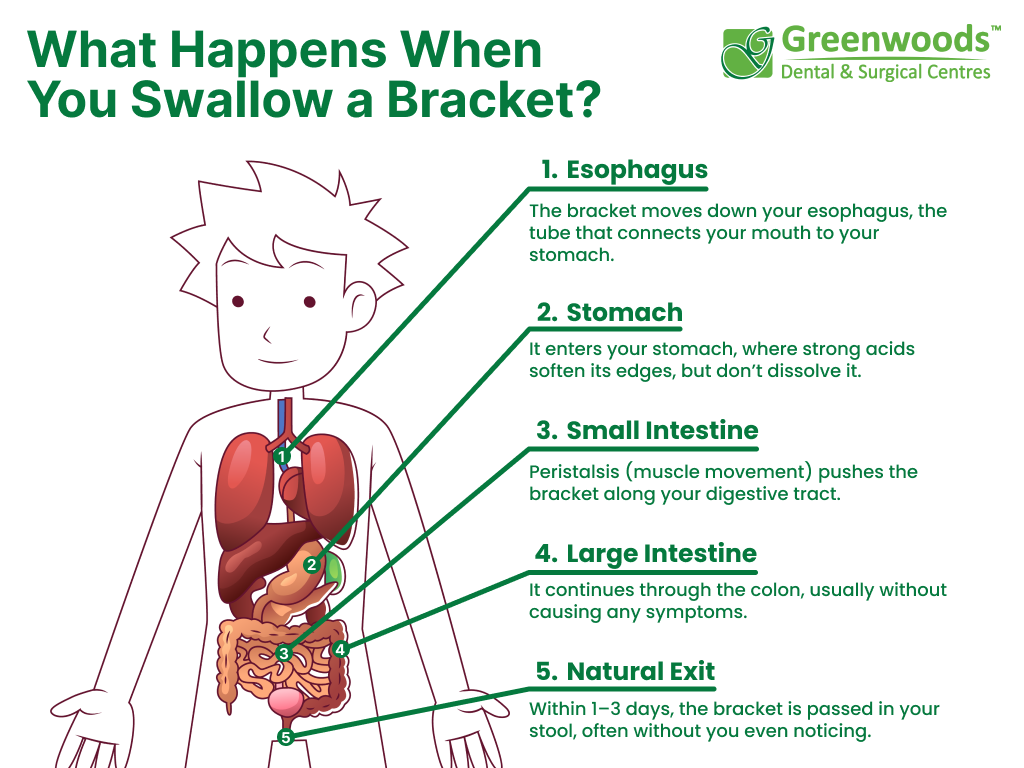 Step-by-step visual of the process after swallowing a dental bracket