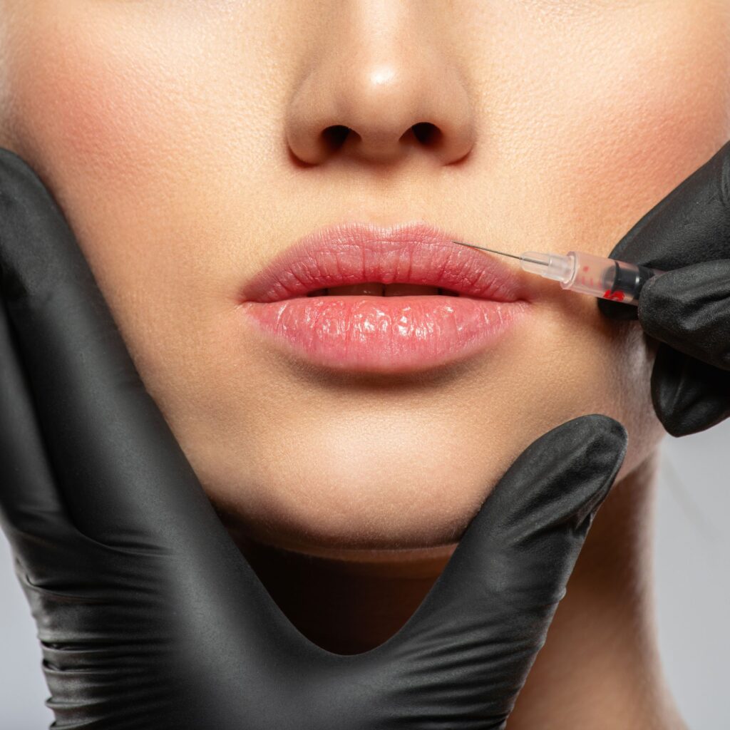 woman having a lip augmentation