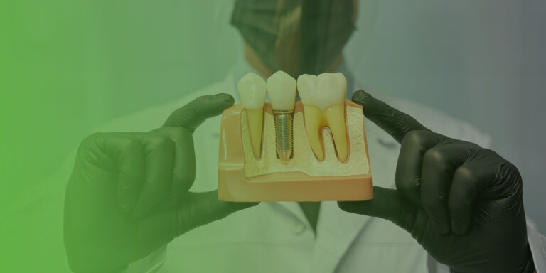 Dental Implants in Masset — Permanent Tooth Replacement in Haida Gwaii